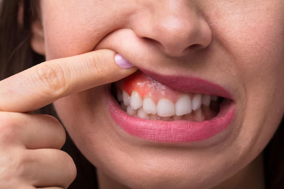 What If You Have Bone Loss or Gum Disease? Your Path to Dental Implants